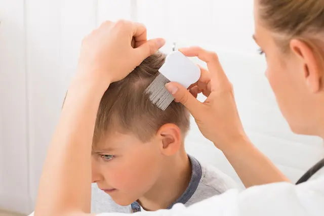 Rescue & Shelter Baby Angel Hair - Head Lice Removal Treatment Indio